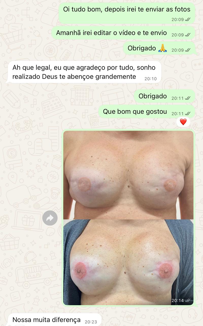 Mensagem de agradecimento de cliente após reconstrução areolar